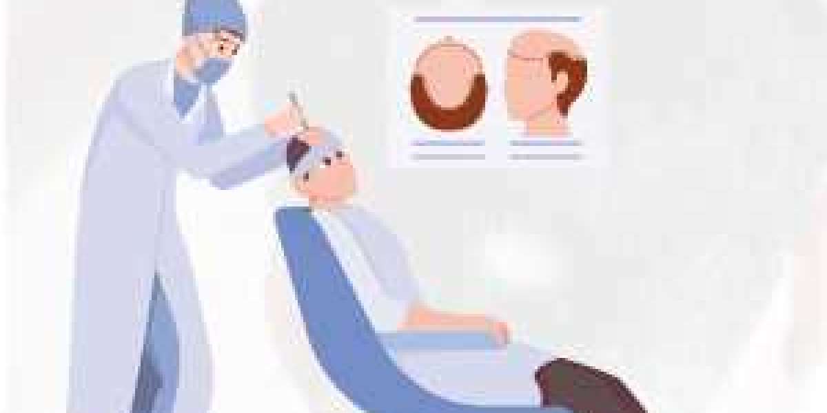 Alopecia Treatment Market Industry Improvement Status And Outlook By 2029