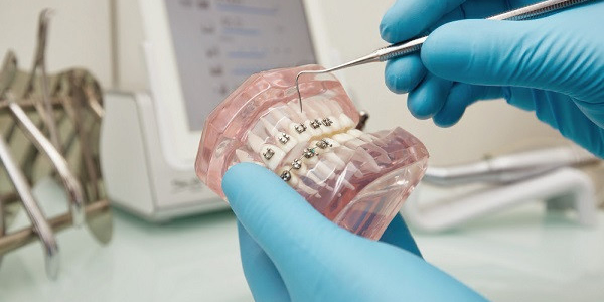 Dental Biomaterial Market Scope Competitive Scenario by 2032.