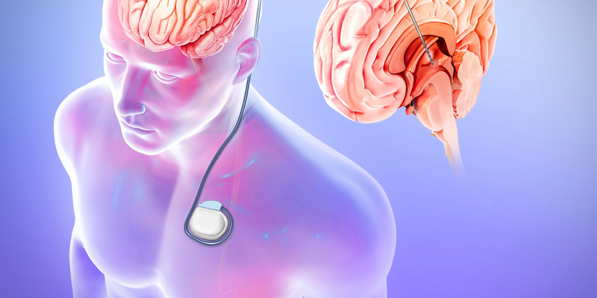 Epilepsy Surgery Market Players To See Prolific Expansion In The Upcoming Forecast Period