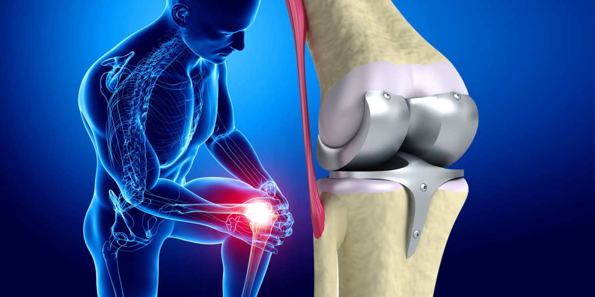 Knee Replacement Market Players: Detailed Analysis of Qualitative as Well as Quantitative Aspects