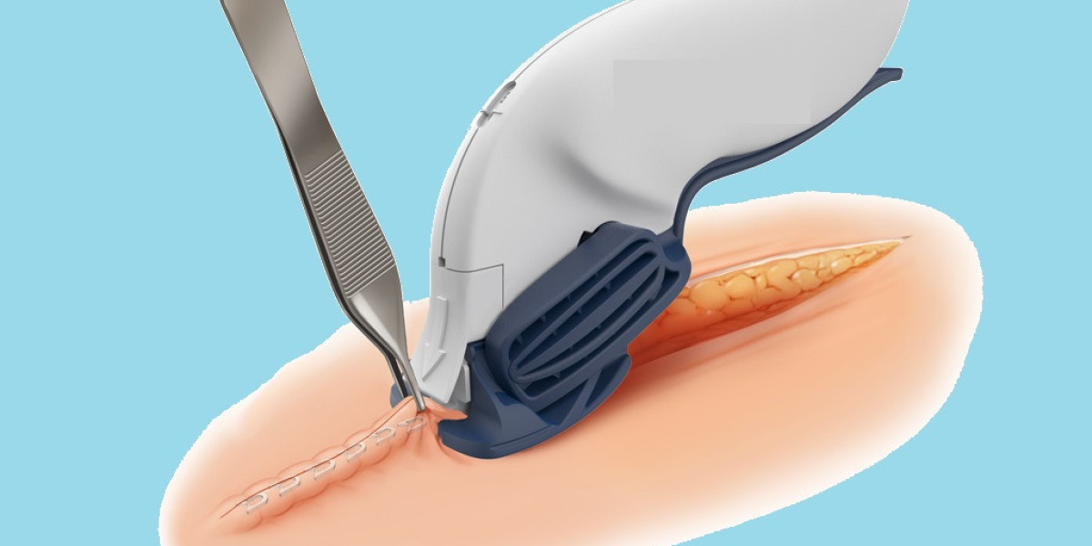 Surgical Staplers Market Players Share Poised to Grow Due to Product Development of Low Cost