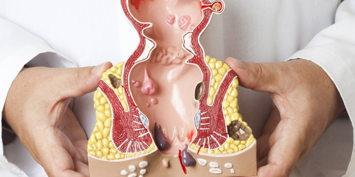 Hemorrhoid Treatment Devices Market Players Share to Accrue USD 1.4 Billion At A Whopping 7.3% CAGR By 2030