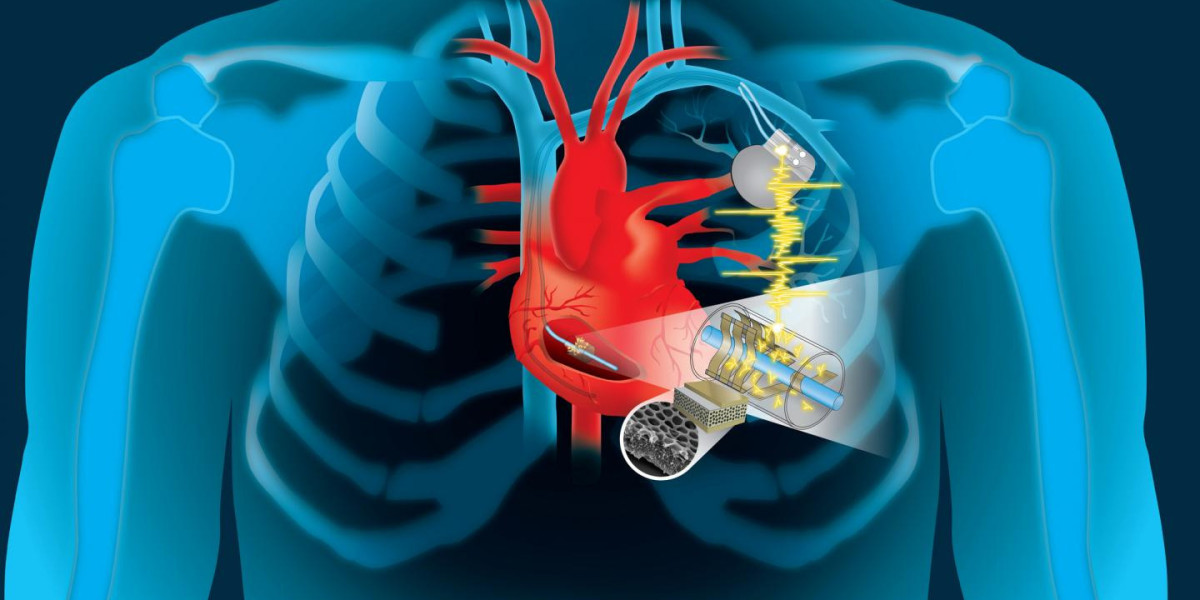 Rising Participation of Cardiac Implants Market Players Boost the Industry Growth in Upcoming Years