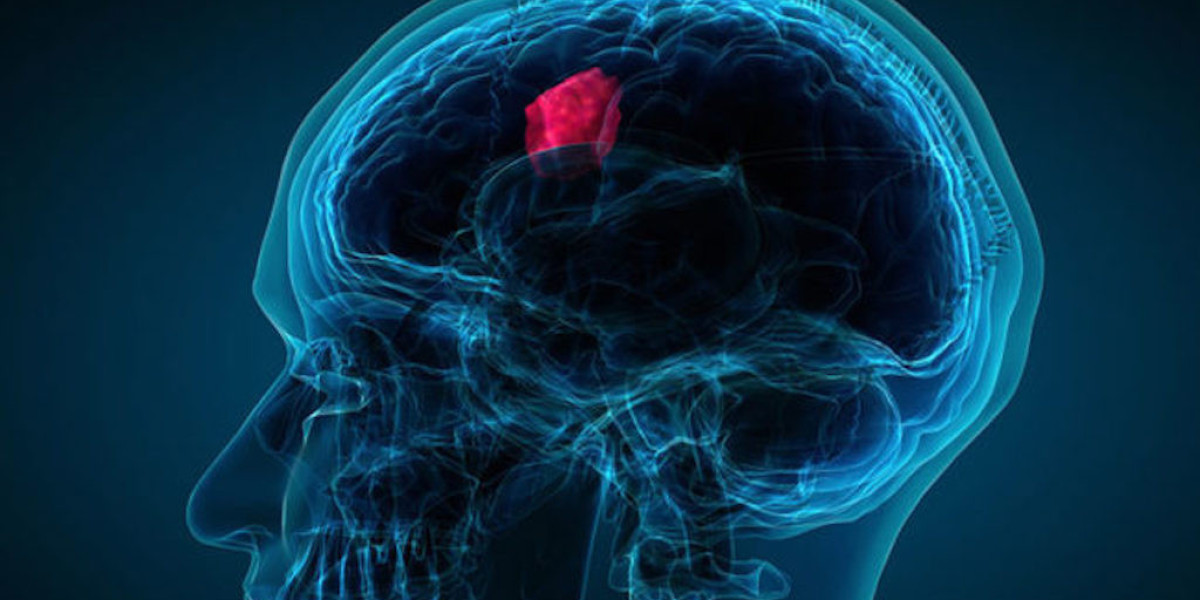 Pediatric Brain Tumor Market Players Share to Accrue USD 1843.7 Million by 2030