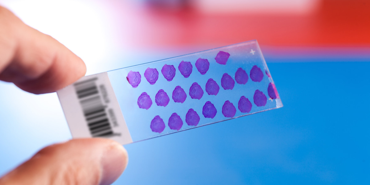 Tissue Microarray Market Players Performance & Insights