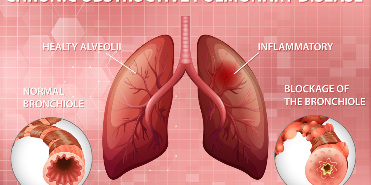 Chronic Obstructive Pulmonary Disease Market Players with Regional Segmentations