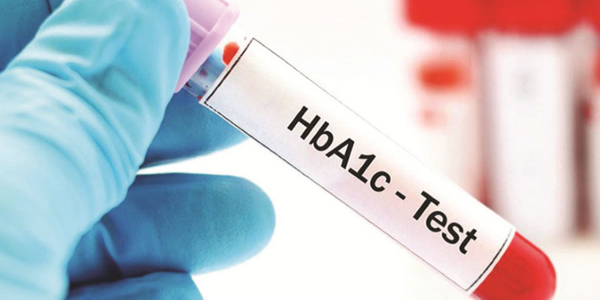 Global HbA1c Testing Market Players Share to Witness a Thriving Growth by 2030; MRFR Unleashes Insights