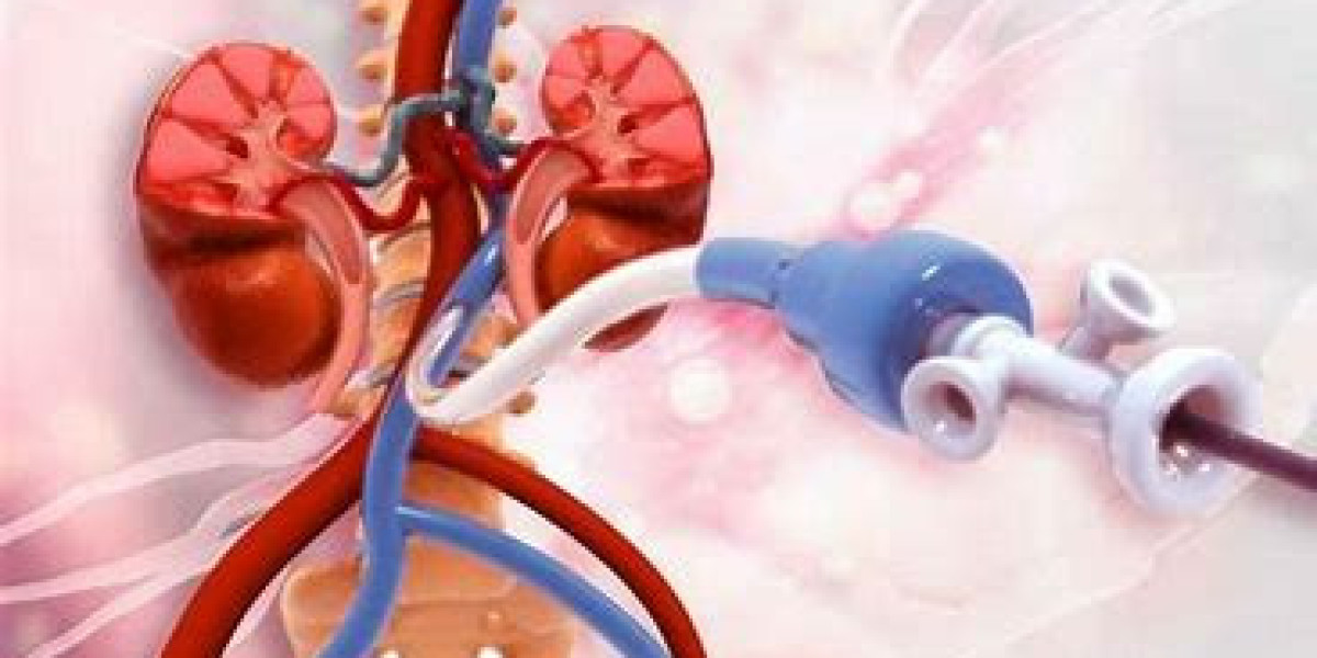 Peripheral Artery Revascularisation Market  Report | Industry Analysis By Top Key Players Report
