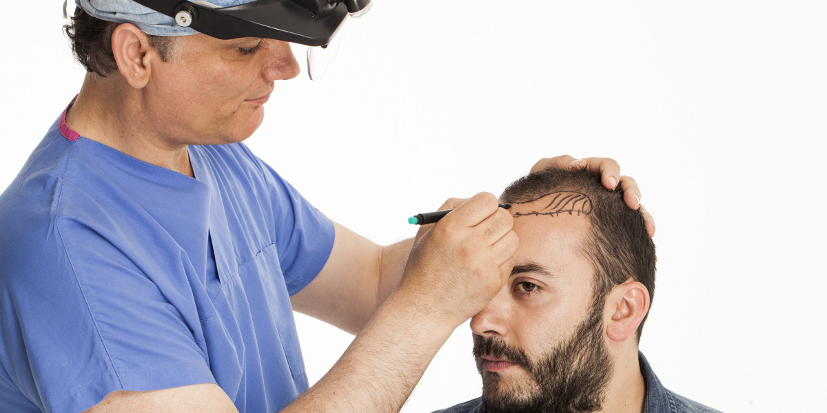 Hair Transplant Market Company Profiles and Trends Forecast To 2030