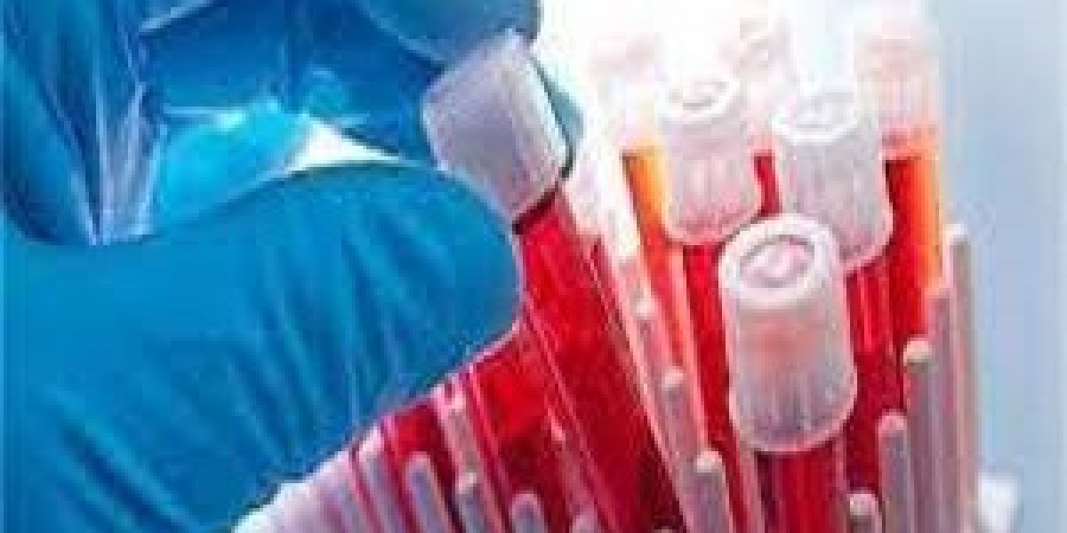 Hematology Diagnostics Market Size, Growth, Industry Demand and Forecast to 2032