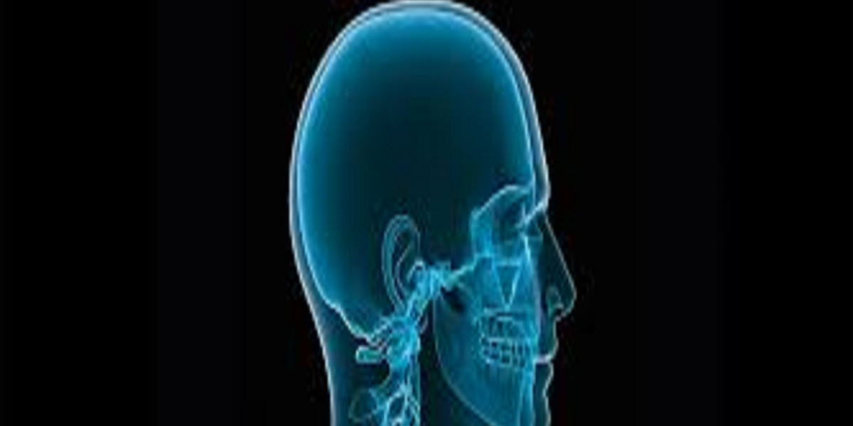 Craniomaxillofacial (CMF) Devices/System Market Trends, Share & Forecast Report to 2032