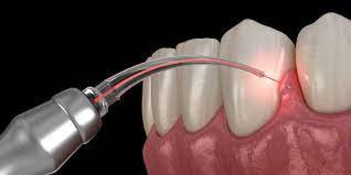 Dental Surgery Lasers Market Share, Size and Industry Forecast Report to 2032