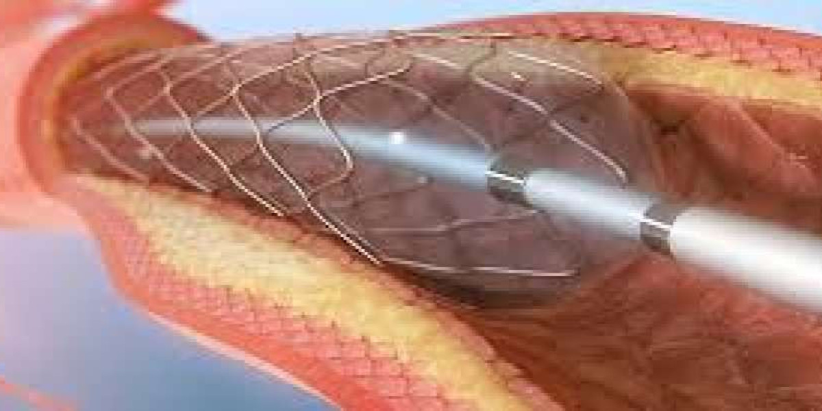 Angioplasty Balloons Market Size, Growth, Industry Demand and Forecast