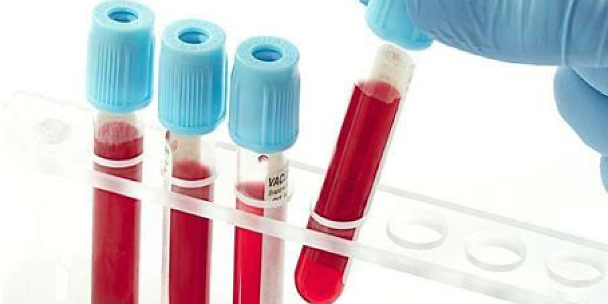 Blood Screening Market | Industry Demand, Fastest Growth, Analysis and Forecast