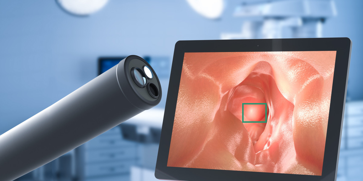 AI in Endoscopy Market 2023 | Industry Demand, Fastest Growth, Opportunities Analysis and Forecast To 2032