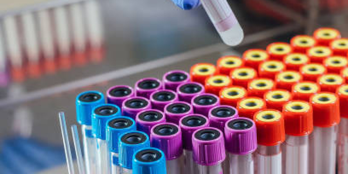 Vacutainer Market 2023: Global Forecast to 2032