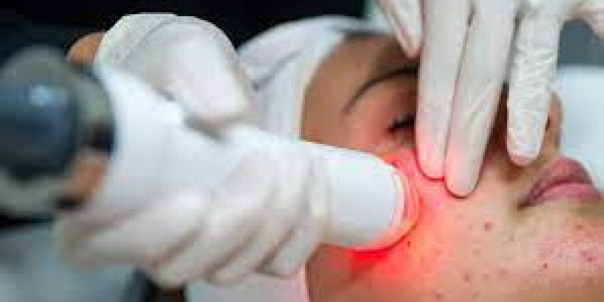 Non-Invasive Aesthetic Treatment Market Size, Dynamics & Forecast Report