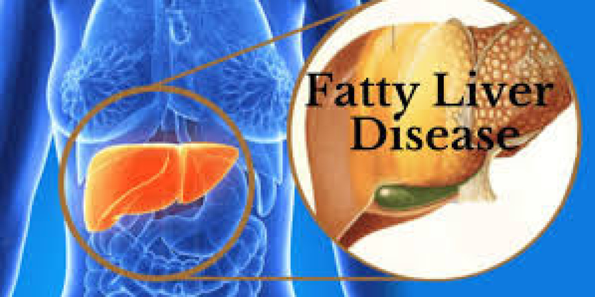 Fatty Liver Treatment Market | Global Industry Trends, Segmentation, Business Opportunities & Forecast To 2032
