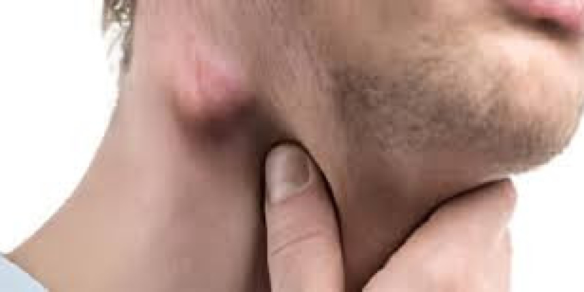 Lymphadenopathy Market Competitive Landscape and its Industry Growth Prospect By 2032