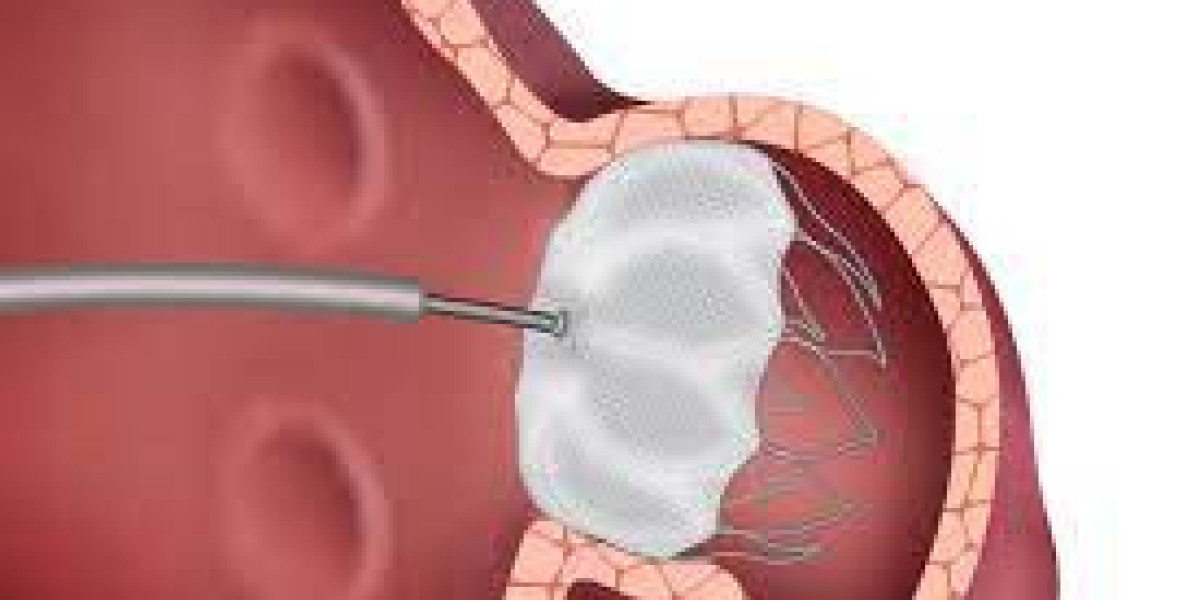 Left Atrial Appendage Closure Device Market Size, Growth Factors & Forecast Report