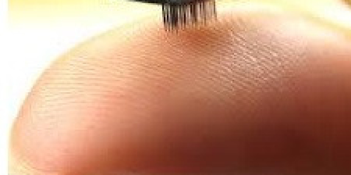 Micro-Electronic Medical Implants Market Size, Growth & Industry Research Report, 2032