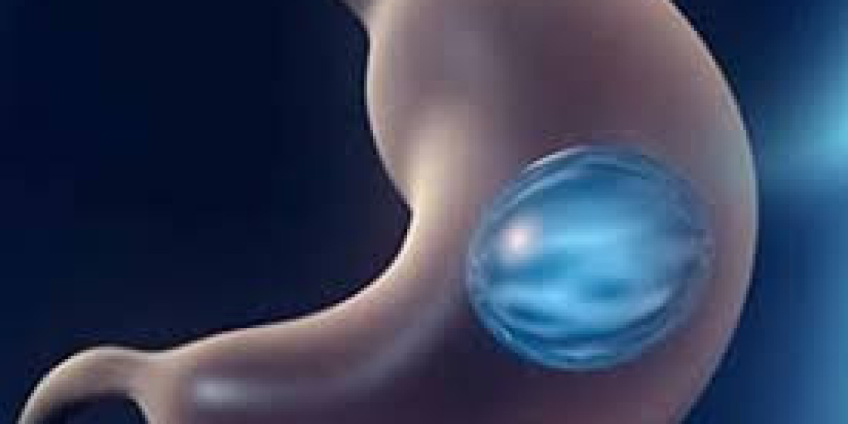 Intragastric Balloon Market Key Players, Share & Latest Trades Report