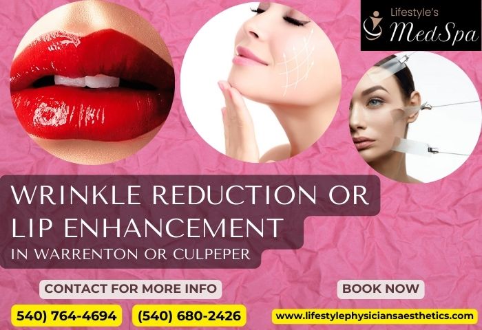 Lip Fillers: A Suitable Option to Enhance Your Lips | Lifestyle MedSpa | Vipon