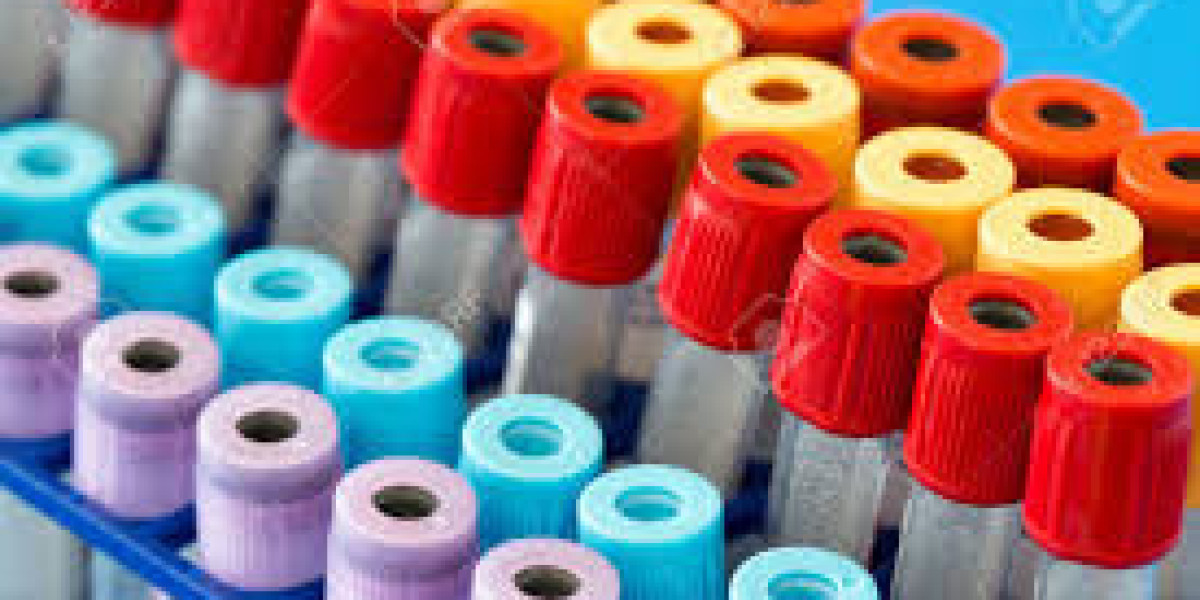 Test Tube Market Size, In-depth Analysis Report and Global Forecast