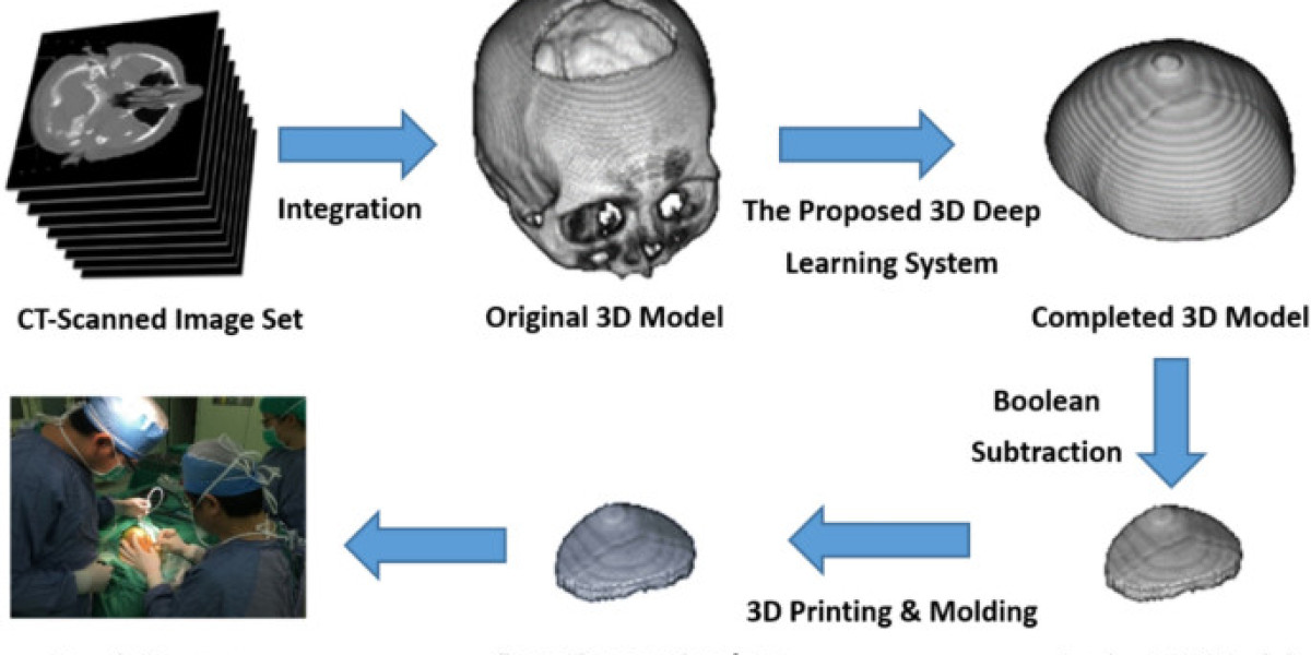 Global Cranial Implants Treatment Market Report with Analysis of COVID-19 Impact