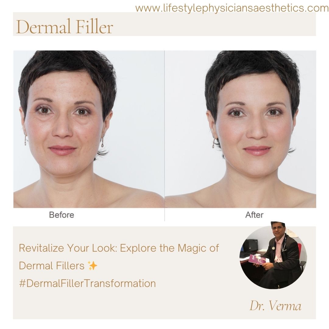 Before & After Medical Aesthetics at Lifestyle MedSpa in Warrenton & Culpeper, VA | Article Terrain