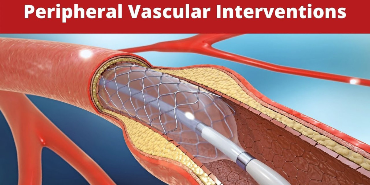 Peripheral Interventions Market Size, Growth Factors & Forecast Report