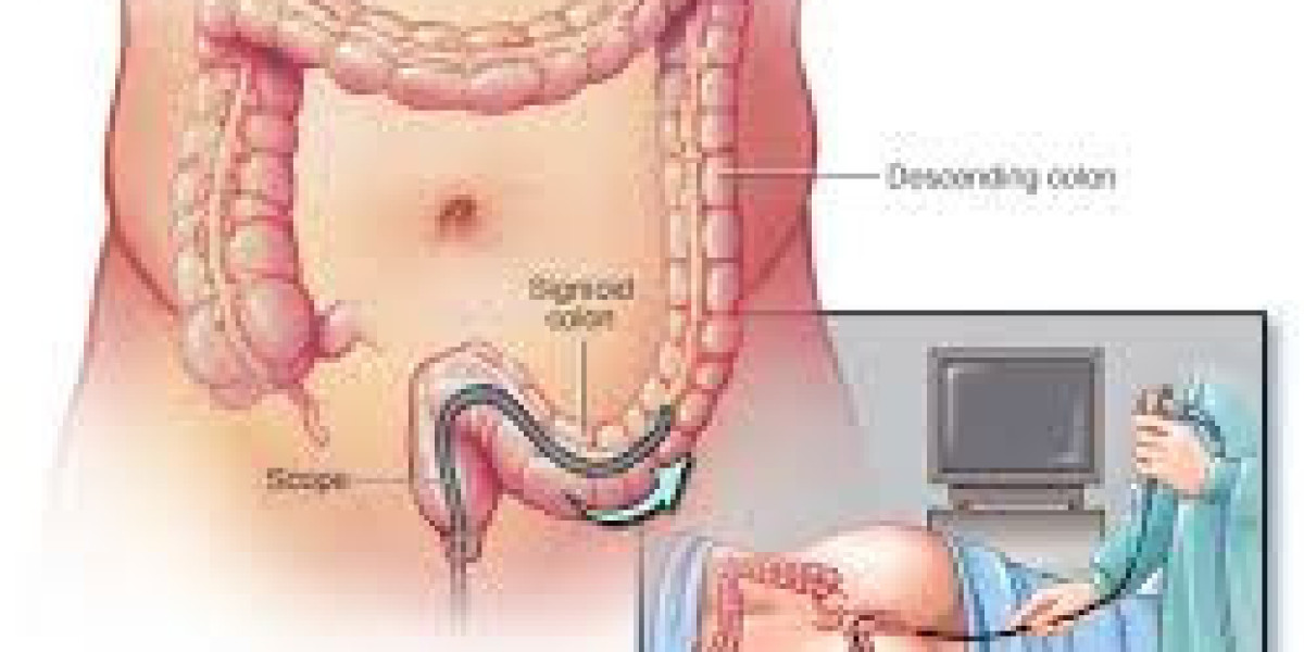 Radiation Proctitis Treatment Market Size, Share & Forecast Report