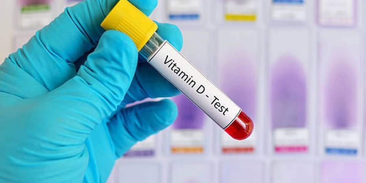 Understanding the Importance of a Vitamin D Test