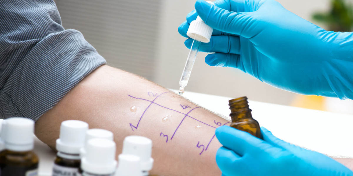 Global Allergy Diagnostics Market | Industry Analysis, Trends & Forecast to 2032