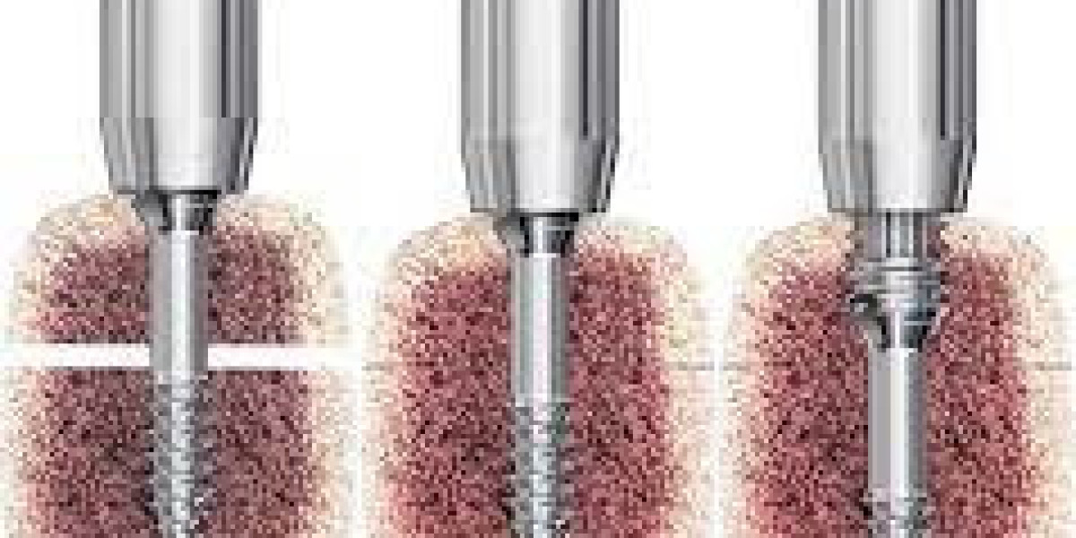 Global Headless Compression Screws Market Report - Impact Of Covid-19 And Benchmarking