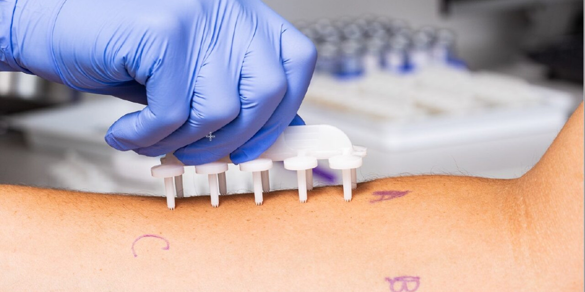 IgE Allergy Blood Tests Market 2023-2032 | Global Industry Research Report By Value Market Research