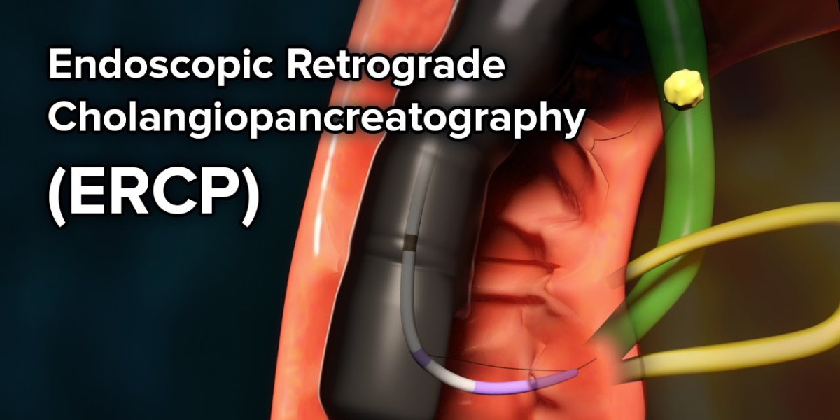 Endoscopic Retrograde Cholangiopancreatography Market Size, Share, Regional Overview and Global Forecast to 2032