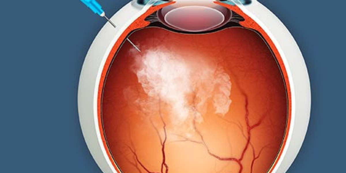 Retinitis Pigmentosa Treatment Market Size, Growth & Industry Research Report, 2032