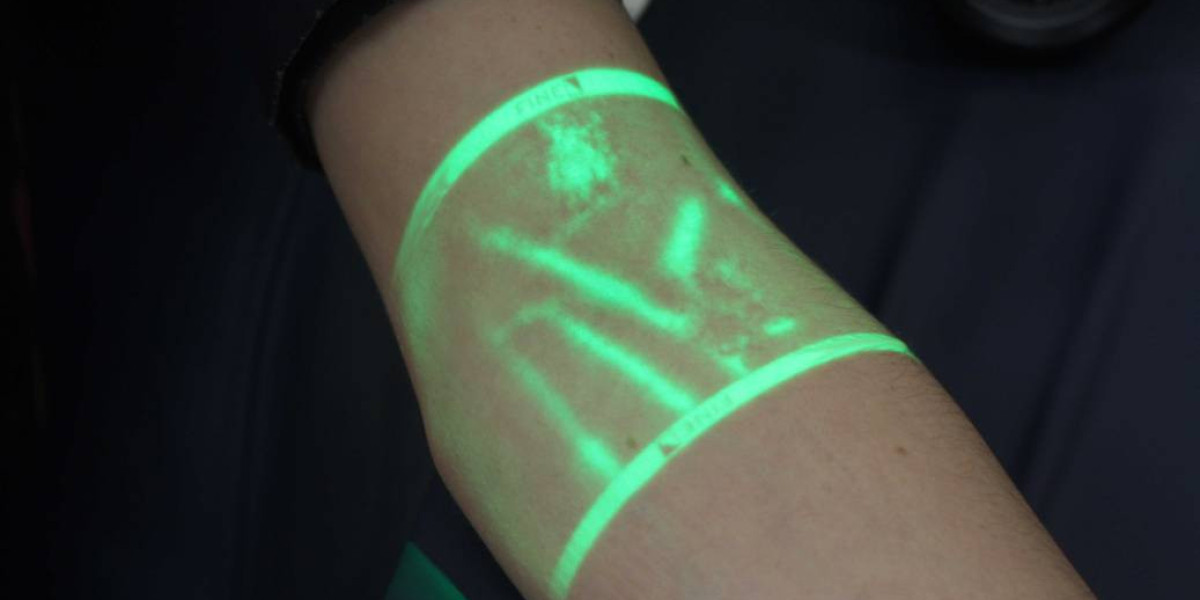 Vein Illuminator Market, Projected to Reach USD 1700 Million by 2033