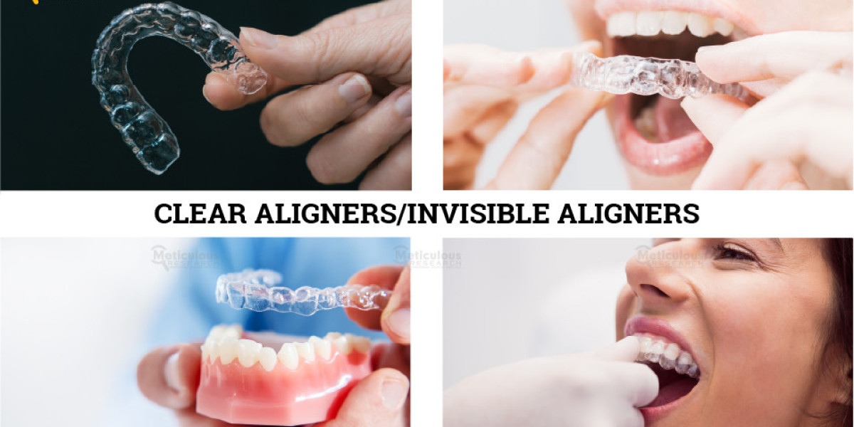 The Future of Orthodontics: Clear Aligners Market Set for Explosive Growth
