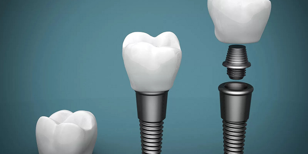 Understanding Healing Abutments: A Crucial Step in Dental Implant Success