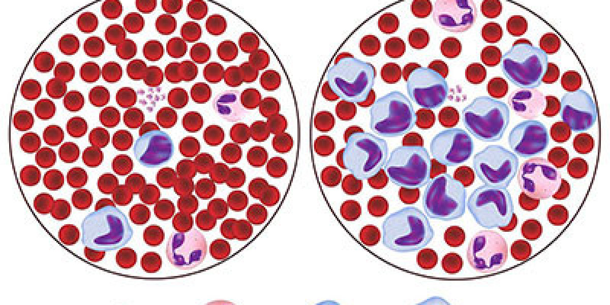 Leukemia Market Size , Growth, Trends, and Forecasts 2024-2031