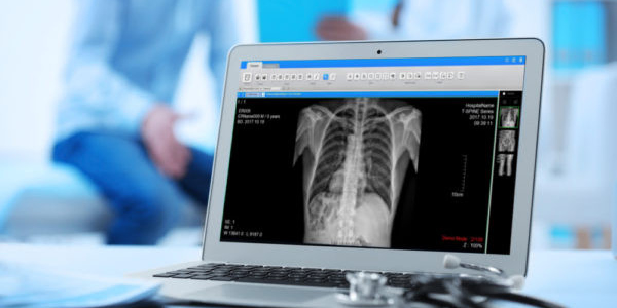 Digital Radiography Detectors Market Size, Industry Analysis Report 2023-2032 Globally