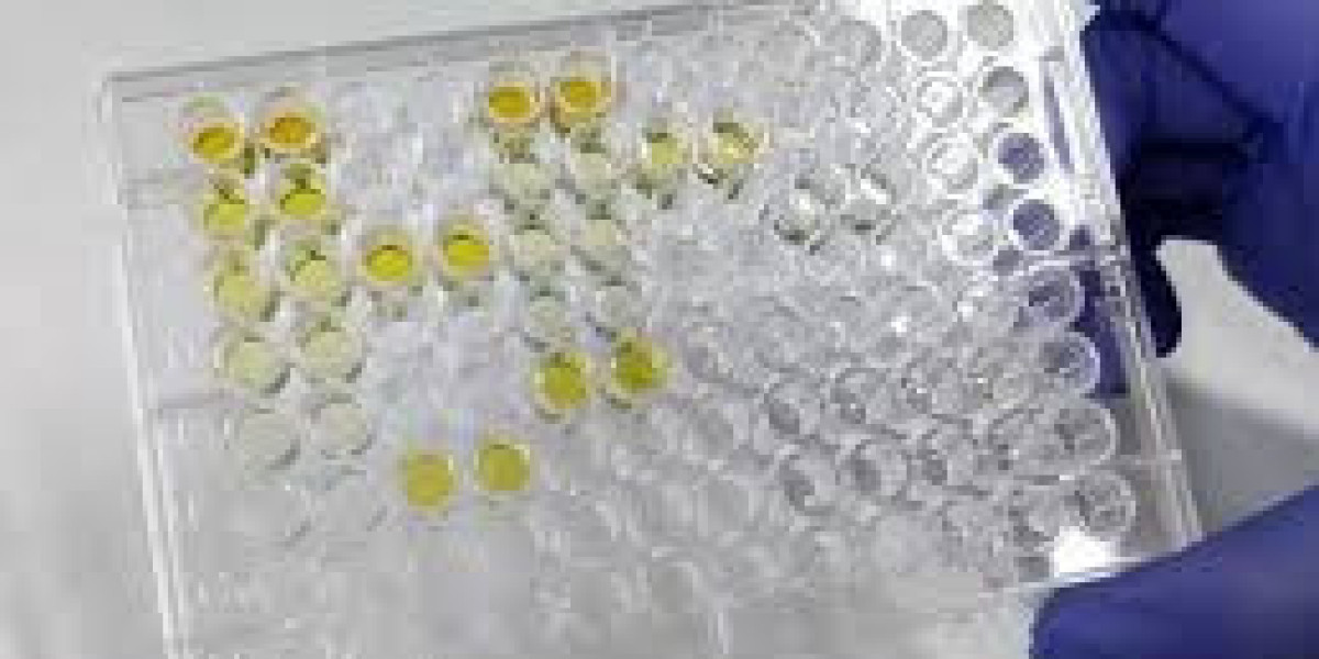 Alkaline Phosphatase Kits Market Size, Growing Trends and Industry Demand Report to 2032