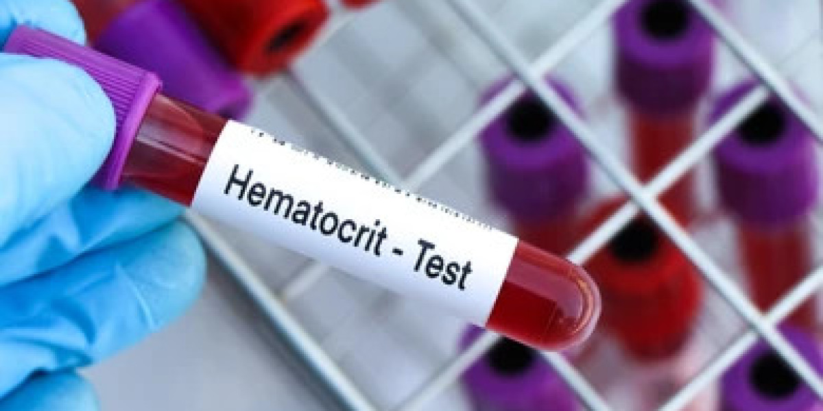 Hematocrit Test Market Size, Outlook Research Report 2023-2032