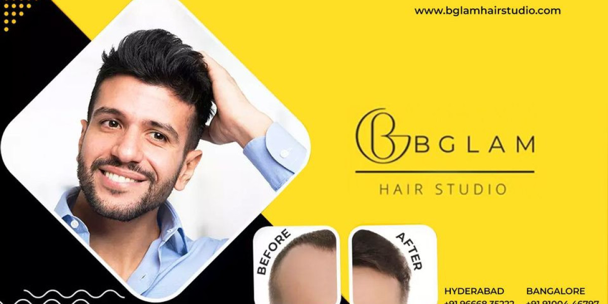 Hair Replacement Services in Bangalore | Bglam hair Studio