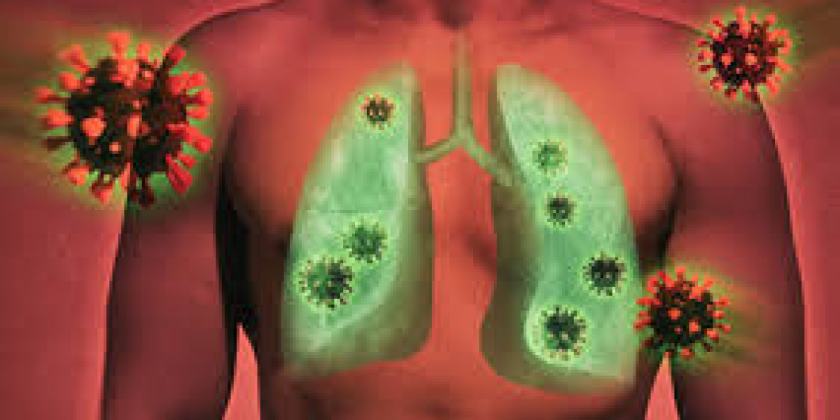 Acute Lung Injury Treatment Market 2023 Major Key Players and Industry Analysis Till 2032