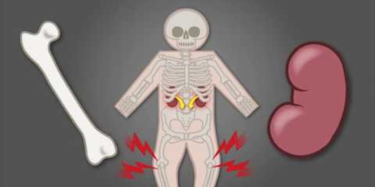 Global X-linked Hypophosphatemia Market 2023 | Industry Outlook & Future Forecast Report Till 2032