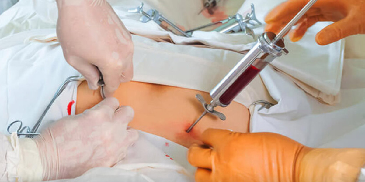 Bone Marrow Transplantation Market Size, Share, Industry, Forecast and Outlook (2024-2031)