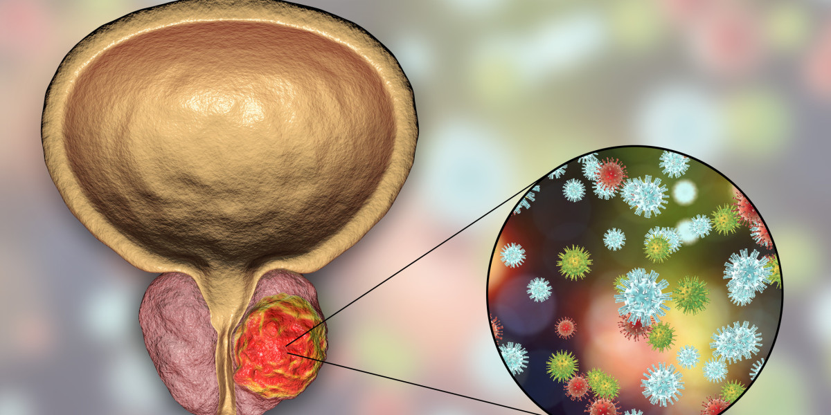 Prostate Cancer Therapeutics Market: Future Opportunities, Analysis & Outlook Report to 2032